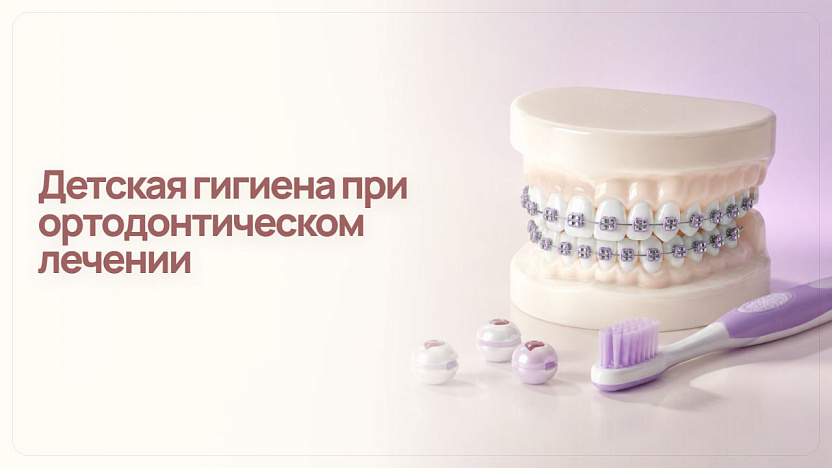 Детская гигиена при ортодонтическом лечении